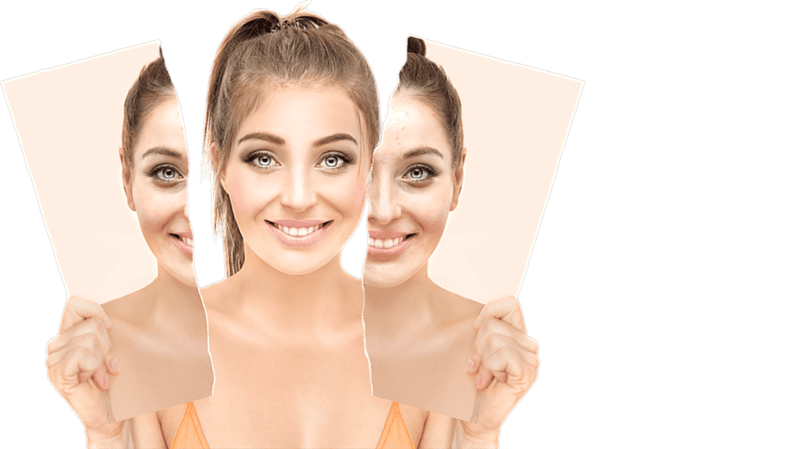 Химические пилинги