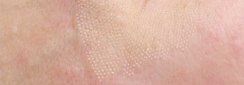 Микроколодцы 1-min.jpg