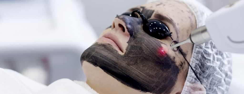 Карбоновый лазерный пилинг в Клинике Алматые.jpg Карбоновый лазерный пилинг в Клинике Алматые.jpg