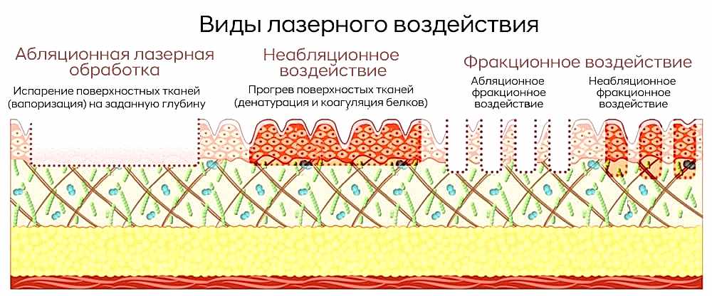 Виды лазерной обработки-min.jpg